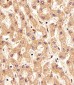 PSMAL Antibody (Center)